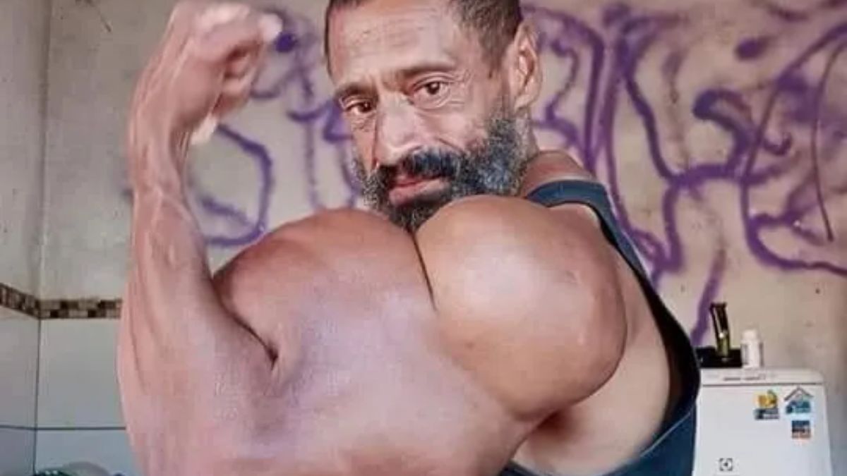 Murió el “Hulk brasileño” que se inyectaba aceite para crear sus enormes bíceps