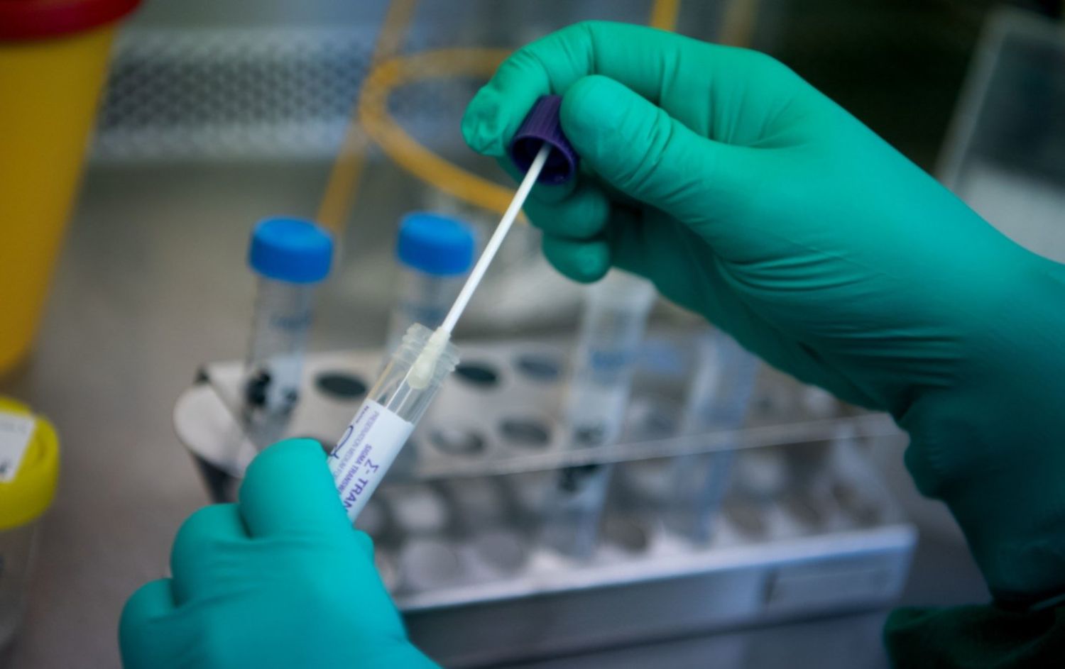 “No hay falsos positivos” dice el médico detectado por COVID-19