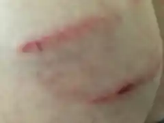 Otro ciudadano fue mordido por un perro