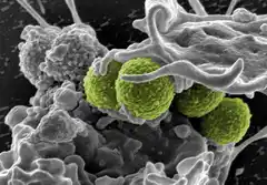 Una de cada ocho muertes estuvo relacionada con infecciones bacterianas, según un estudio