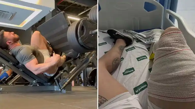 Impactante video: un fisicoculturista se rompió el tendón del cuádriceps al levantar 400 kilos en un gimnasio