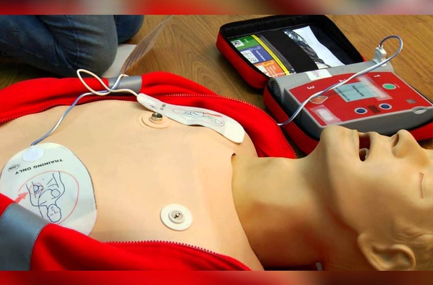 El DEA, un dispositivo indispensable para salvar vidas