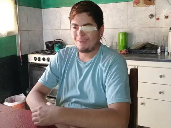 Lucas necesita ayuda para costear su prótesis ocular