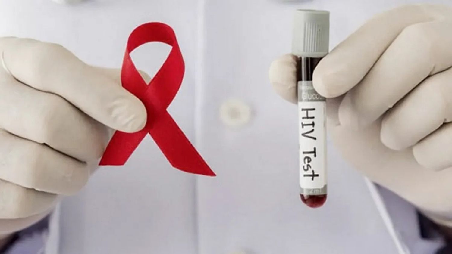 Fallo histórico: condenaron a un hombre por contagiar con HIV a su ex pareja