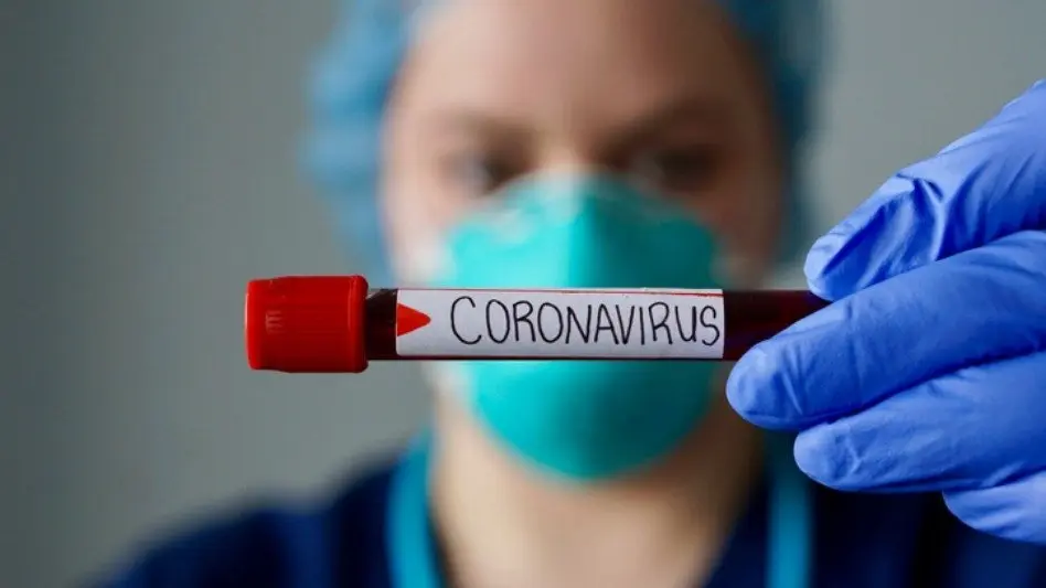 Hay 222 nuevas personas en tratamiento por Covid-19 y 16 muertes informadas 