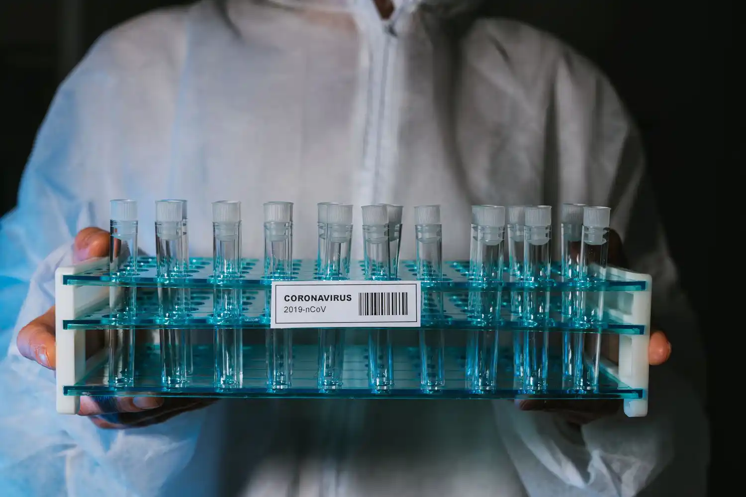 Segunda ola de coronavirus: 15 nuevos casos positivos