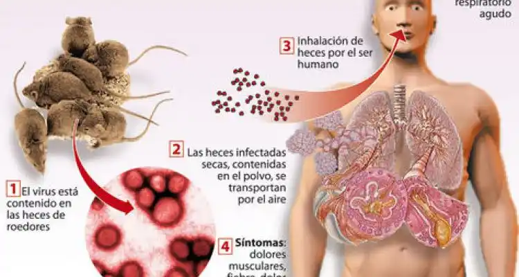 Comienza Campaña Anual de Recolección de Plasma