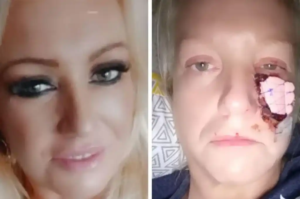 La víctima, madre de dos hijos, ha visto su vida alterada significativamente por el incidente.