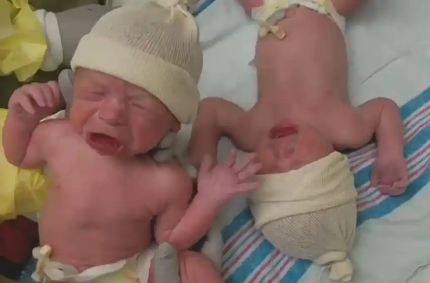 Conexión de hermanos: los gemelos que lloran si separan a uno del otro