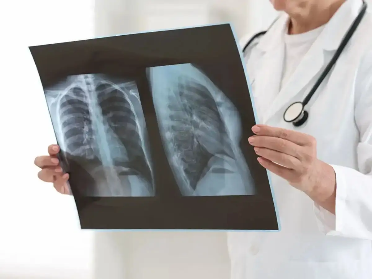 La visita al médico es fundamental para detectar a tiempo el cáncer de pulmón.