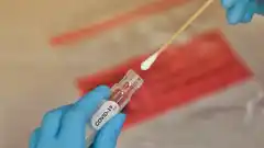 Ya no se debe esperar 72 horas para hisoparse cuando aparecen síntomas