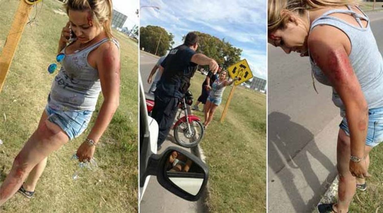 Bahía Blanca: Policía atropelló a una mujer y luego la amenazó para que no lo denunciara