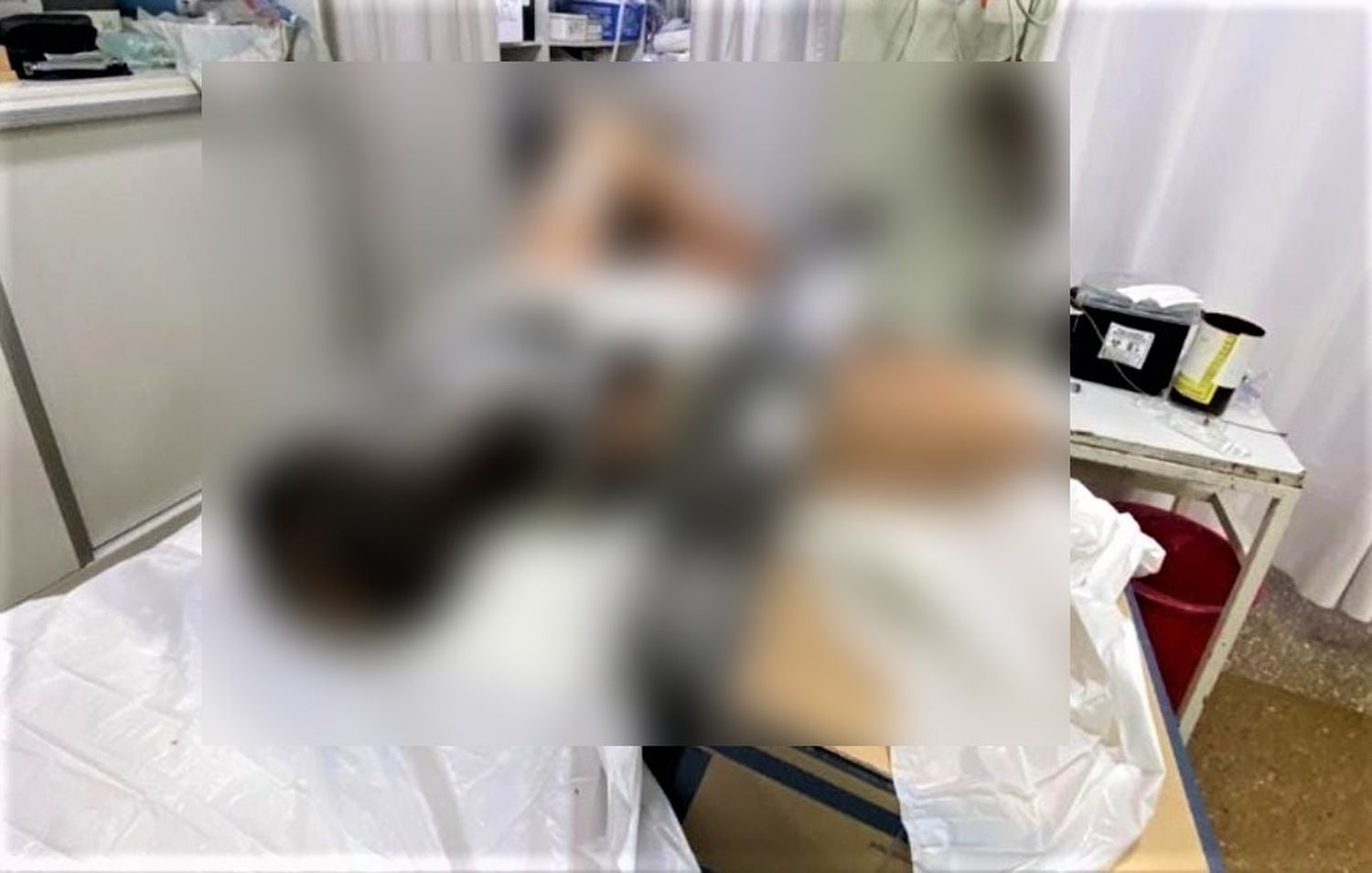 Carnicero perdió tres dedos en máquina de picar carne: lo internaron con aparato y todo