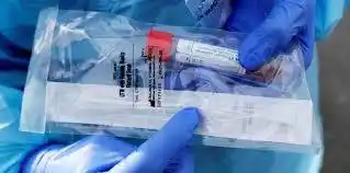 El Gobierno anunció la llegada de 31.000 reactivos para detectar el coronavirus