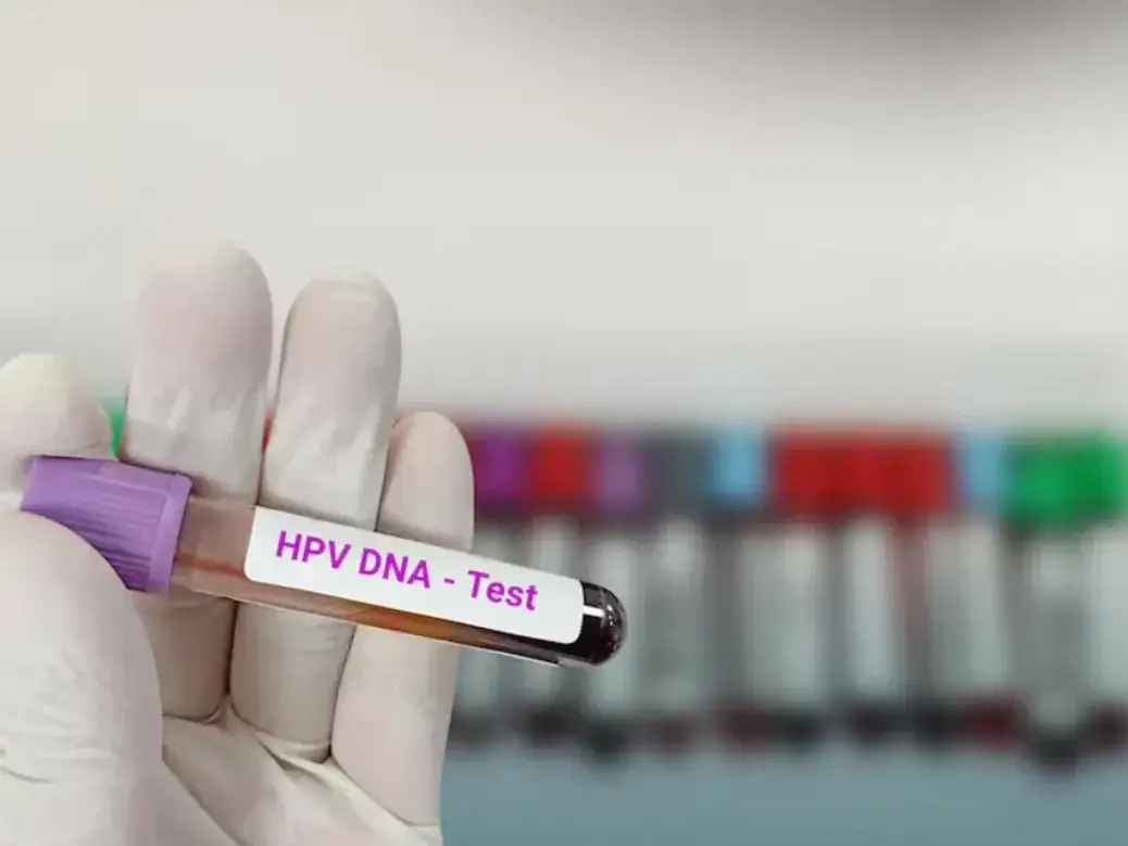 El test de VPH, un estudio clave para la detección temprana de tumores ginecológicos.