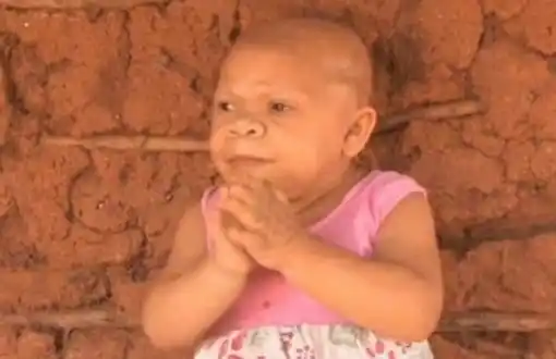 Tiene 31 años pero parece un bebé