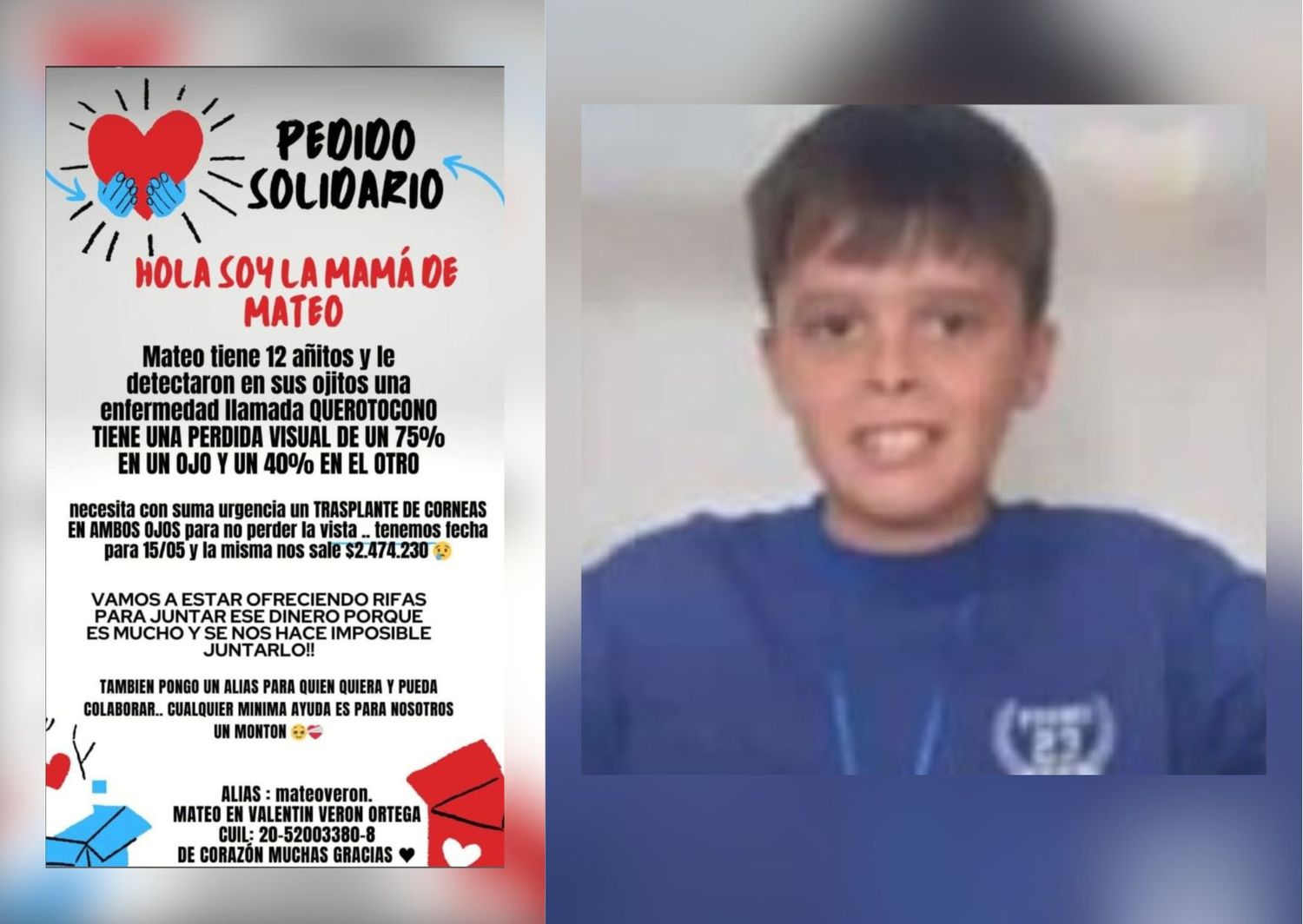 Rifa solidaria para Mateo, un pequeño de 12 años que debe someterse a una cirugía de córnea