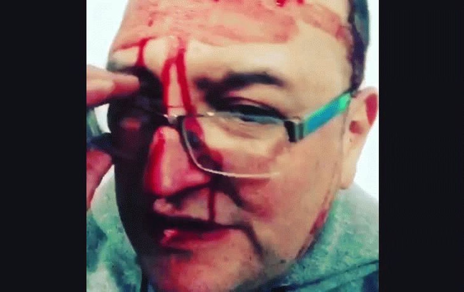 Nuevas imágenes desmienten a Leo García tras la golpiza