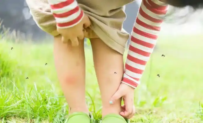 Los cuidados para evitar picaduras y el dengue son distintos en niños que en adultos.