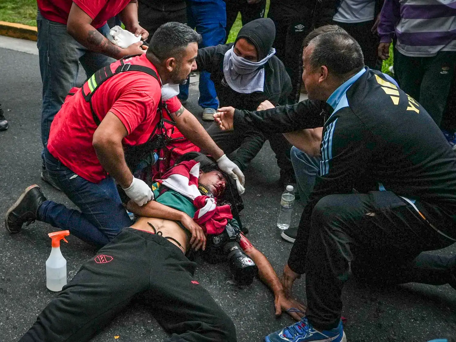 El fotógrafo sufrió el impacto de un cartucho de gas lacrimógeno en la cabeza, lo que le provocó traumatismo de cráneo grave, fracturas múltiples y pérdida de masa encefálica