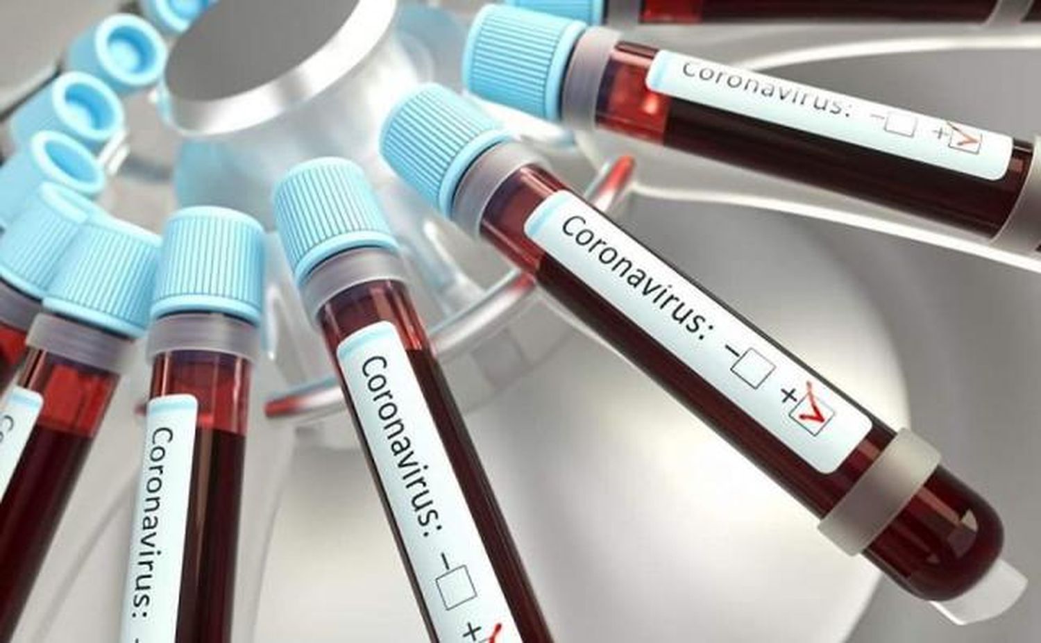 Médica local, dió positivo en Coronavirus.
