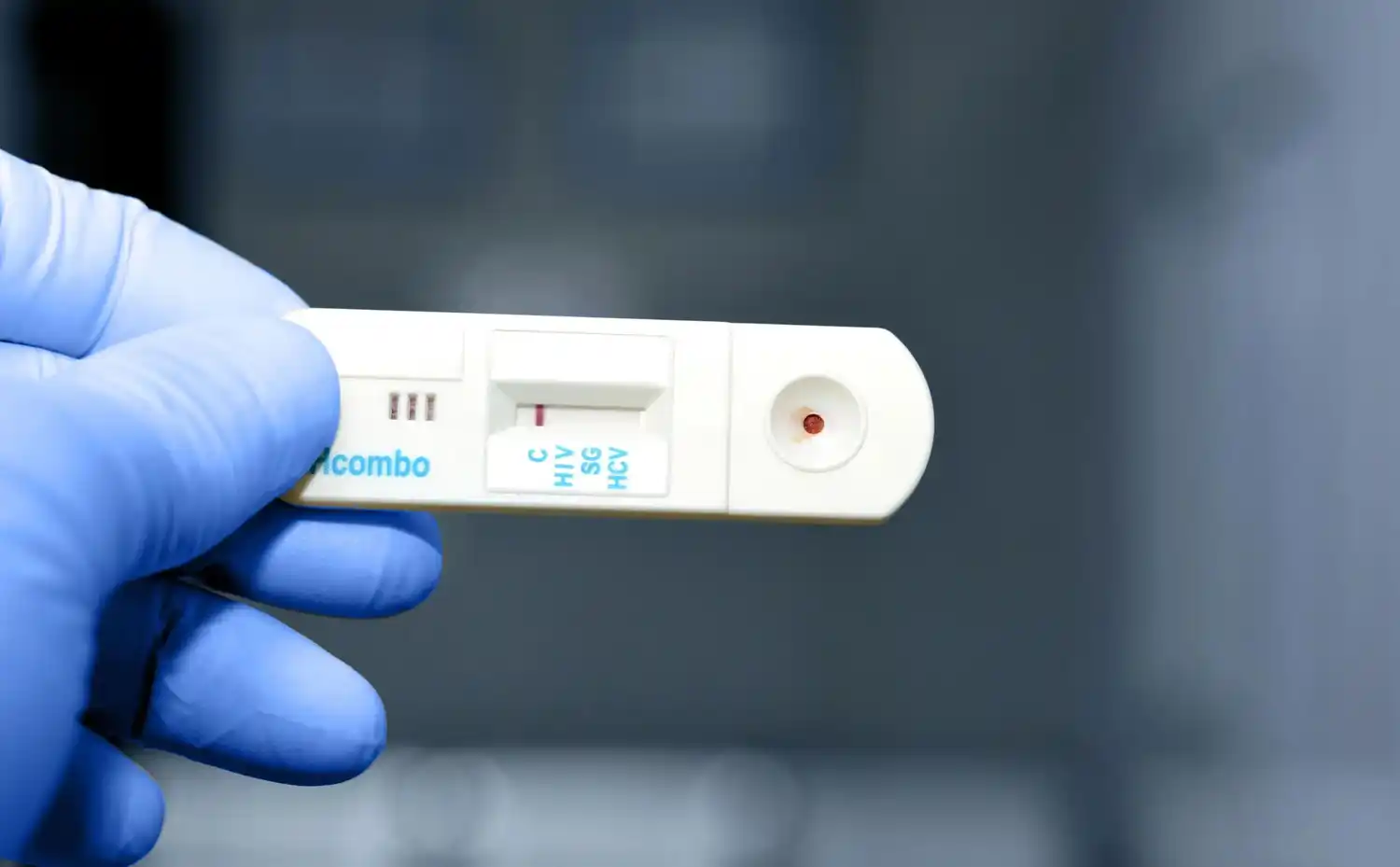 Provincia anunció que cubrirá análisis contra el HIV que dio de baja el gobierno nacional