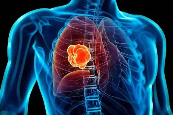 Publican estudio para mejorar el diagnóstico temprano