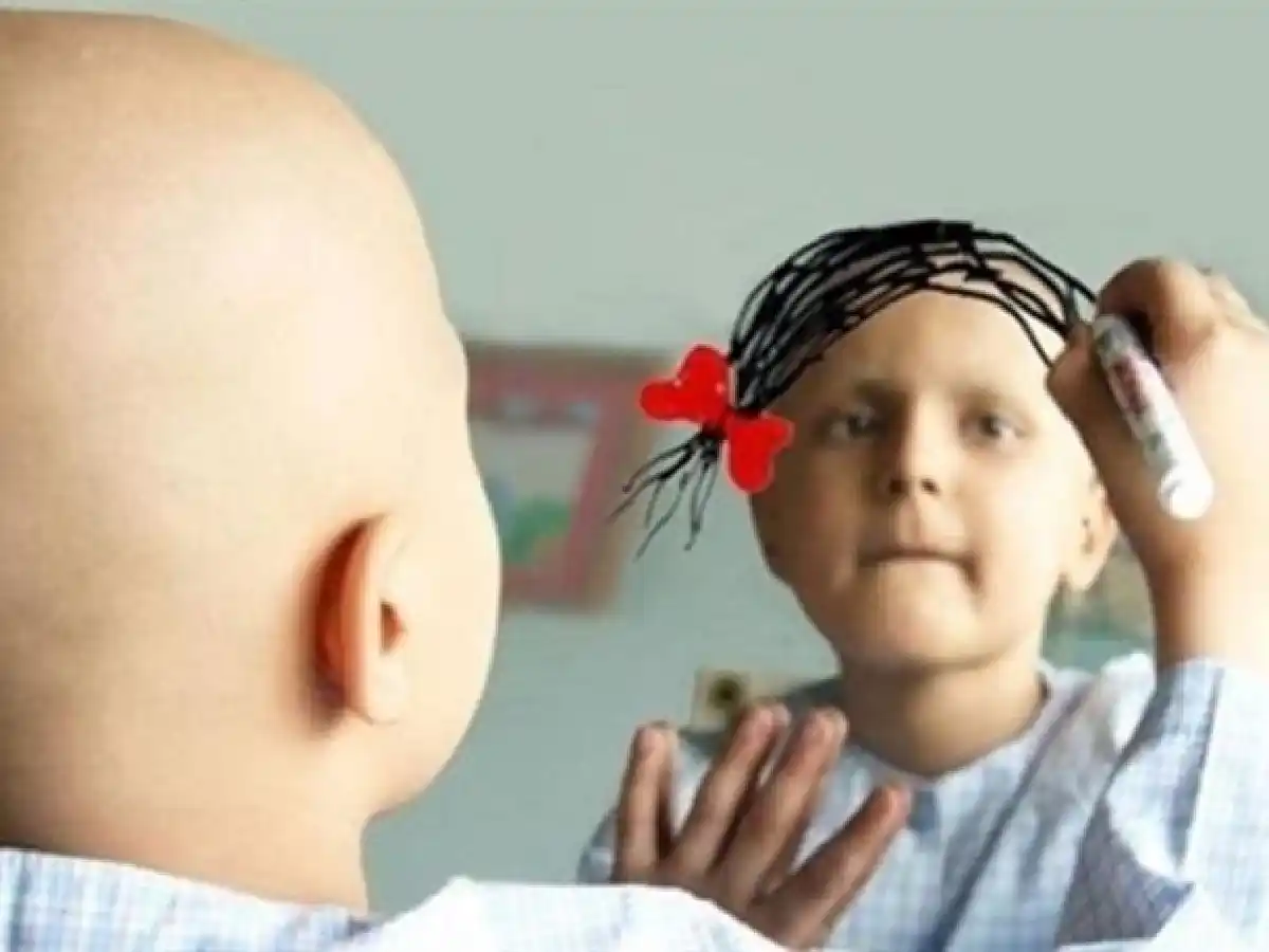 Día Internacional del Cáncer Infantil: la sobrevida aumentó notablemente en Argentina
