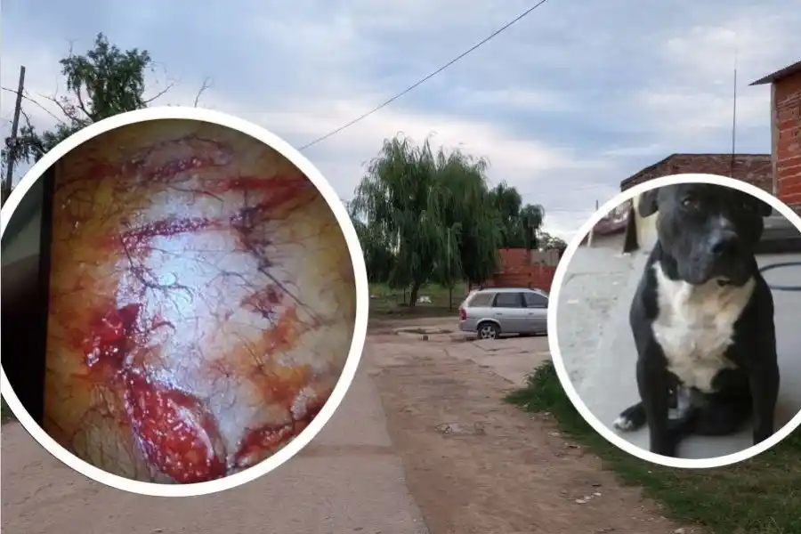 Un pitbull atacó a un policía y debieron matarlo para que lo soltara 