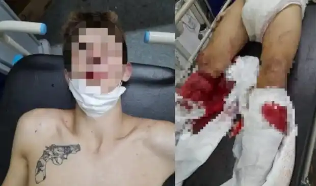 "Martincito", el homicida más buscado de Lomas de Zamora: Tiene apenas 15 años y resistió su detención a los tiros