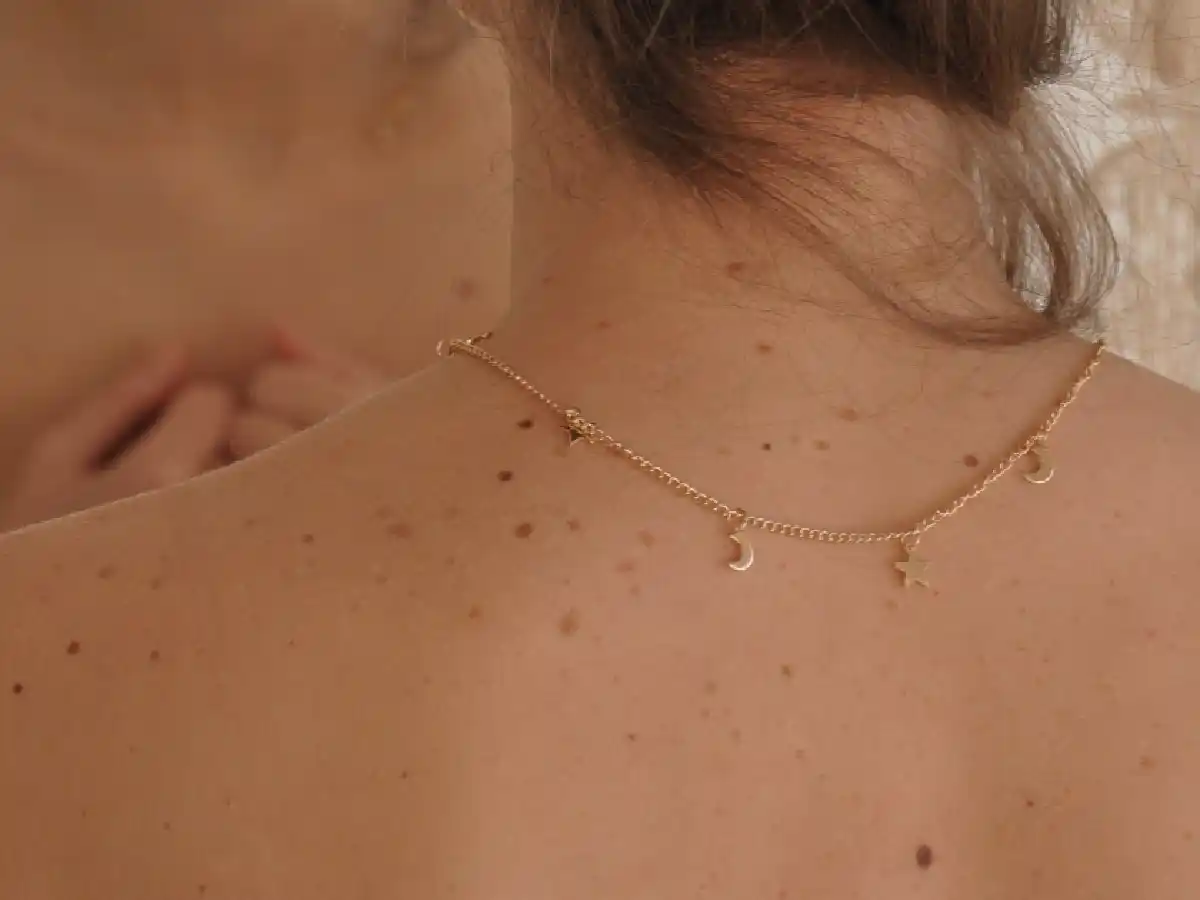 Cáncer de piel: cuidarse del sol, clave para prevenir  