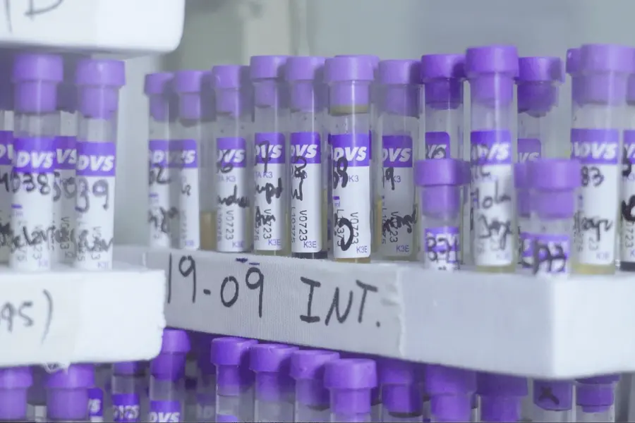 7 vacunas anti-Covid en 3 Continentes: una investigación internacional compara respuestas de anticuerpos