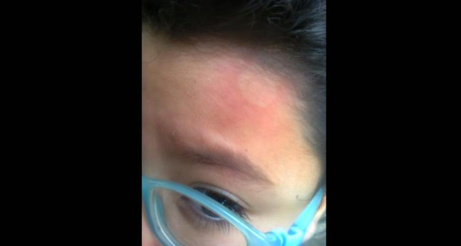 Niño recibió piedrazo cerca de un ojo cuando pasó por una escuela