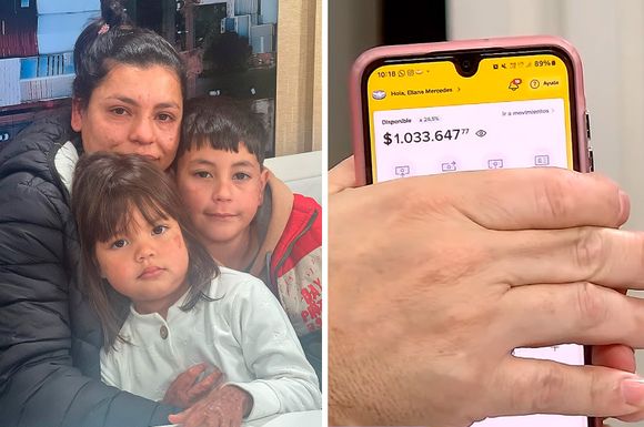 A un año del incendio en barrio Mora, Loan necesita ayuda para otra operación urgente: ¿cómo ayudar?