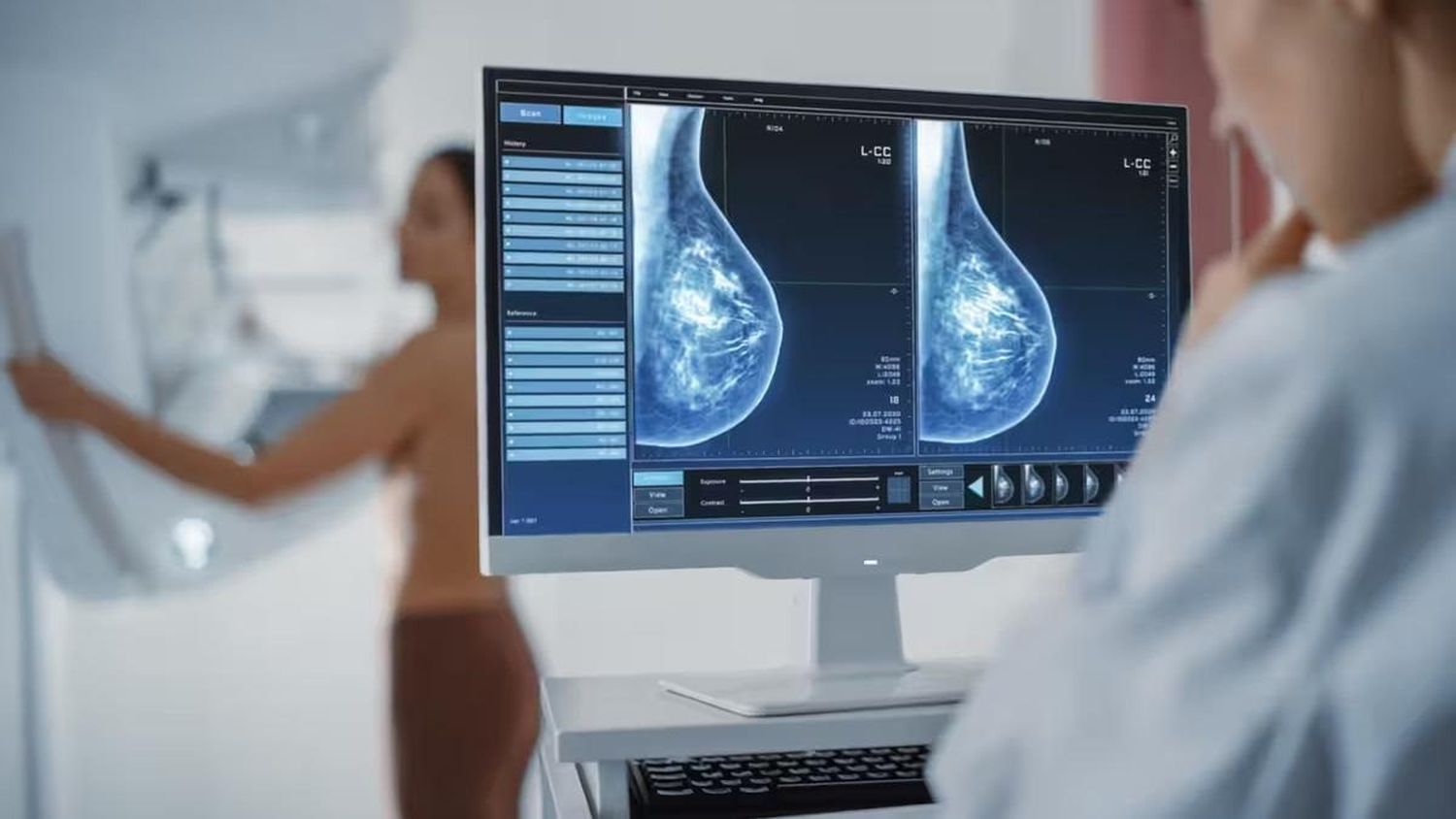 El cáncer afecta cada vez más a los menores de 50 años