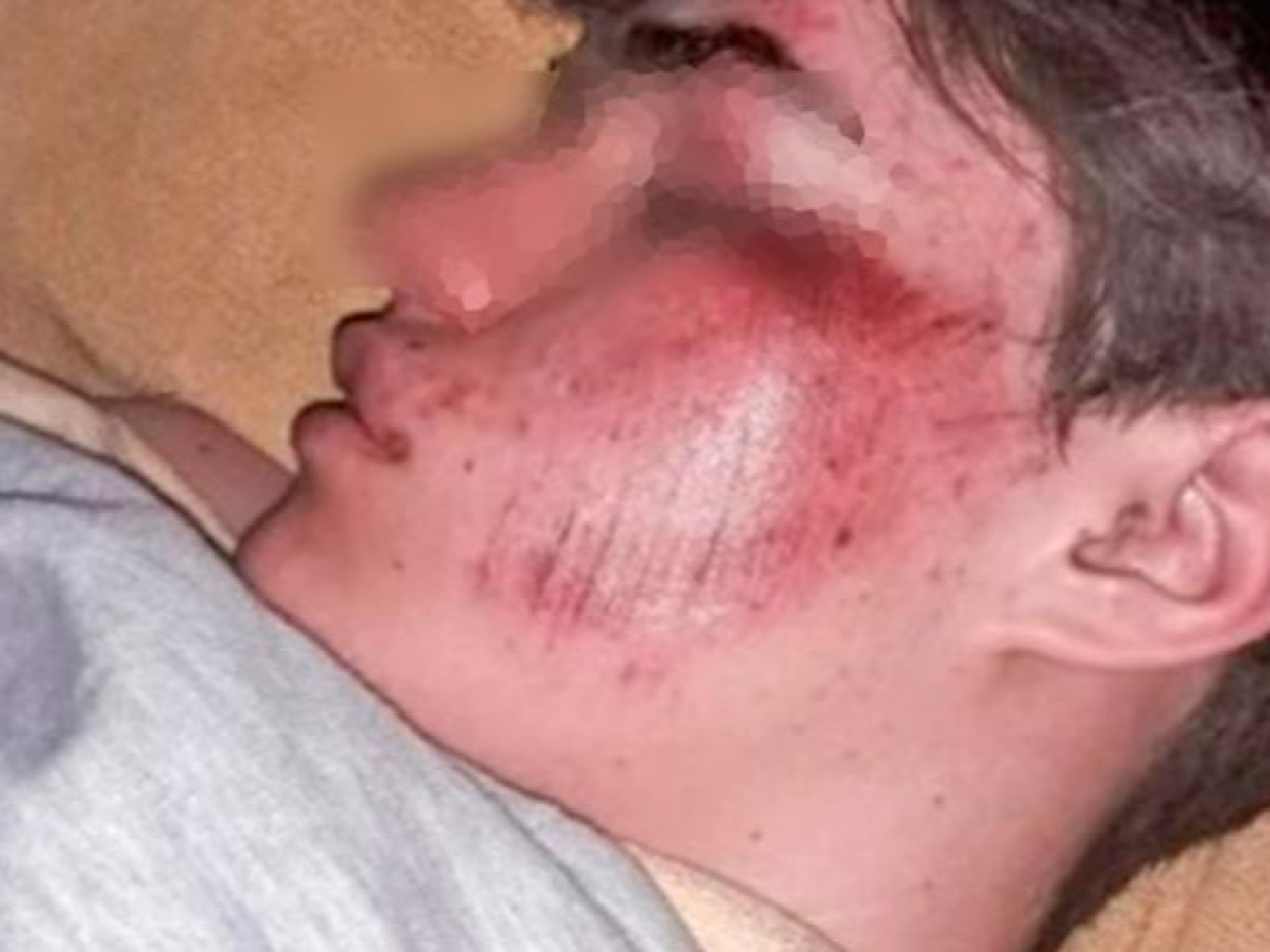 Denuncian que un patovica golpeó a un adolescente hasta dejarlo en terapia en General Cabrera