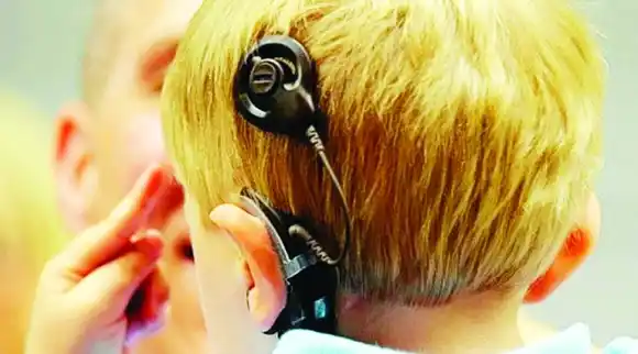 Día internacional  del Implante Coclear