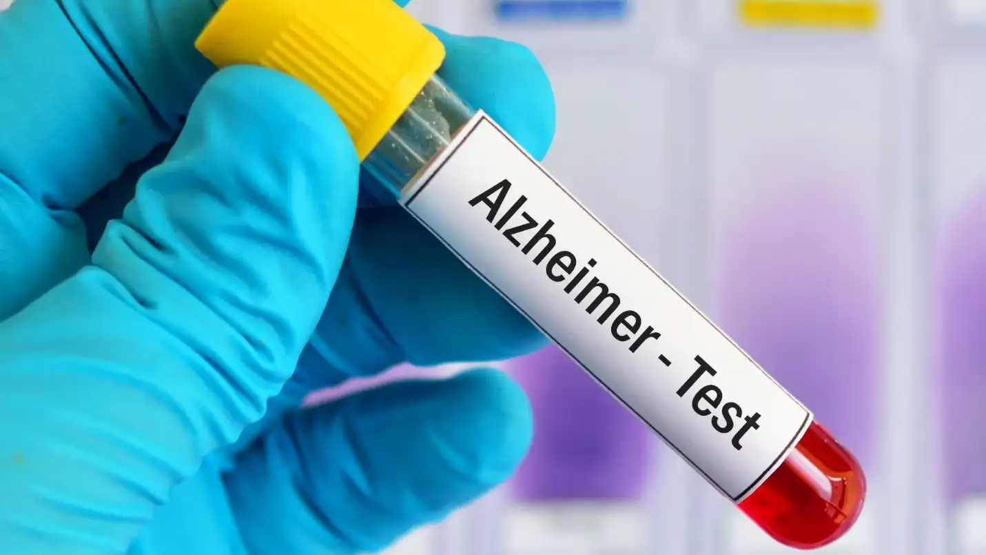 Análisis de Alzheimer.