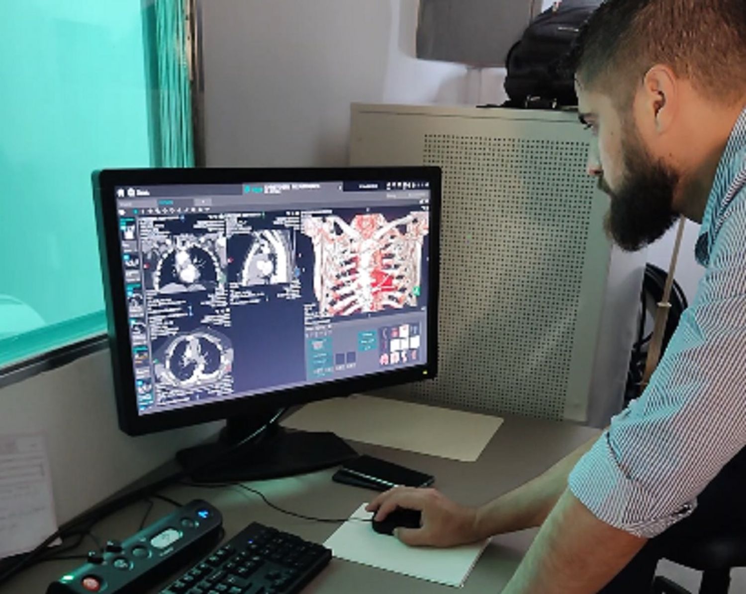 Se comenzaron a realizar en el nuevo tomógrafo del Hospital estudios cardíacos avanzados