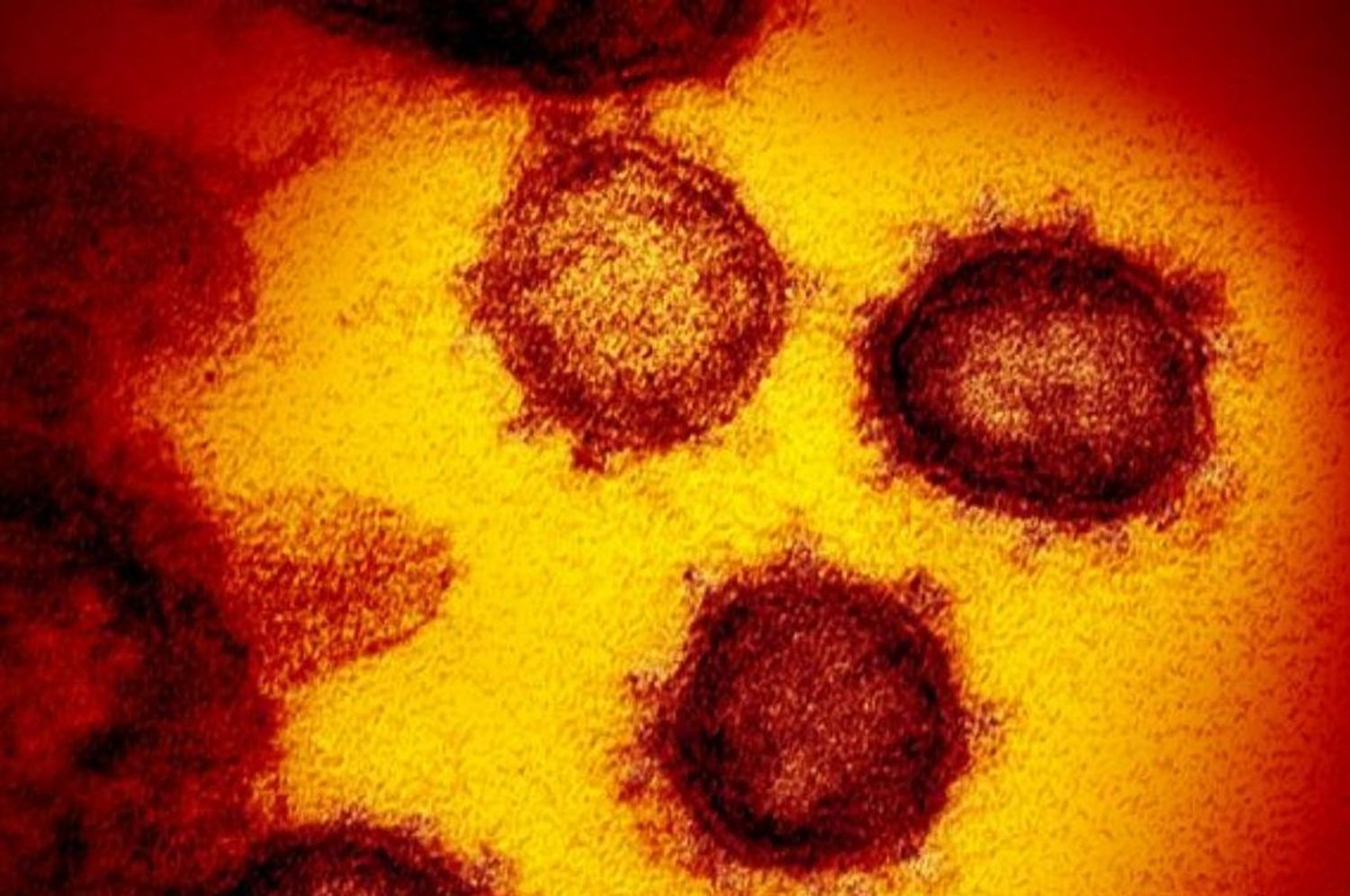 Alerta en Francia: detectan una nueva variante de coronavirus