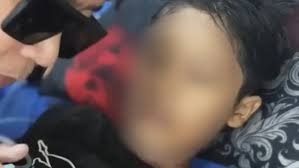 Indonesia: investigan la muerte de un niño de 12 años por quemaduras y apuntan a su madrastra