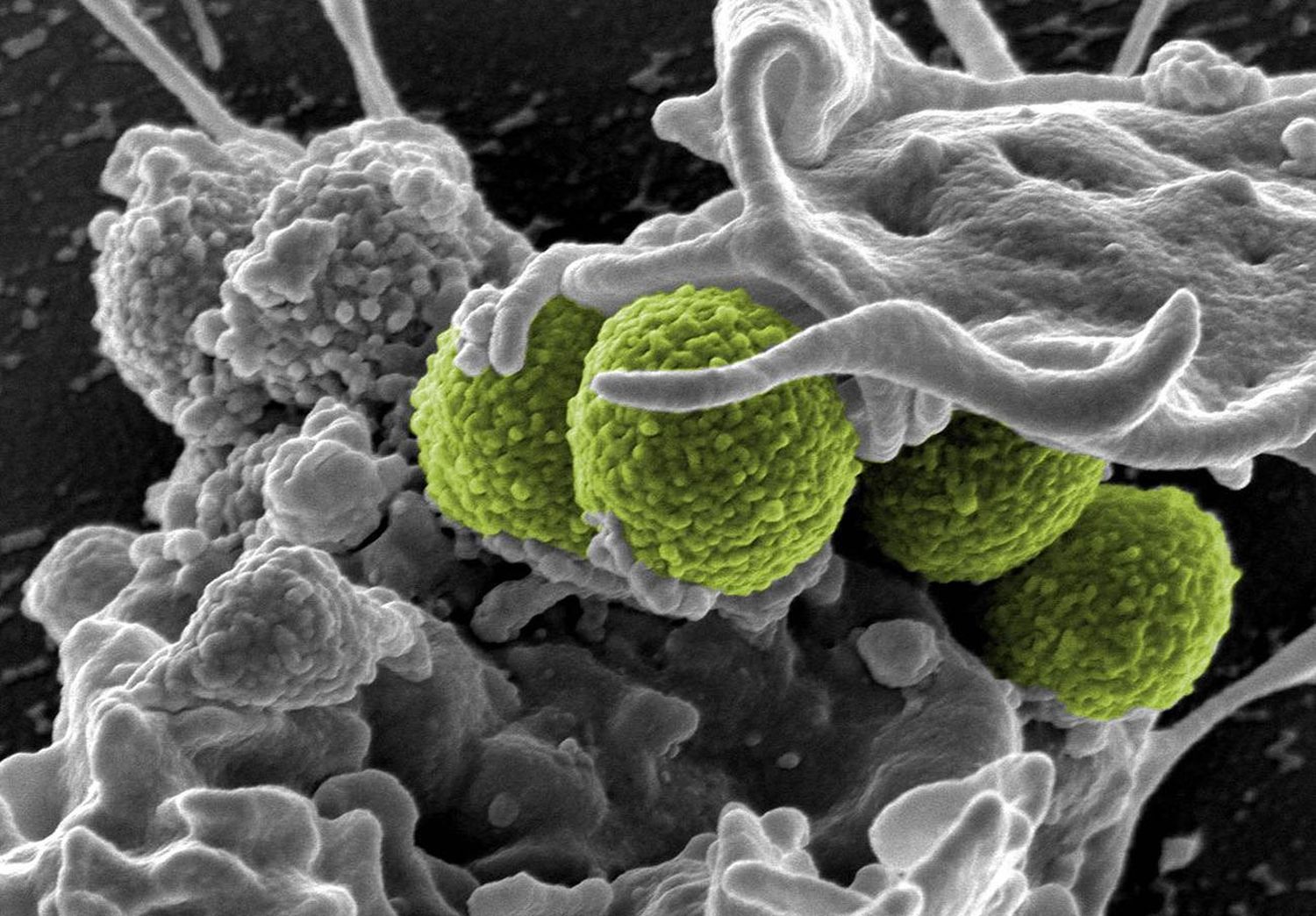 La bacteria ‘S. aureus’ fue la principal causa bacteriana de muerte en 135 países.