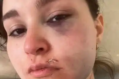 Violencia de género en Solano: ahorcó y apuñaló a su pareja y le cortó la cara a su beba de un año