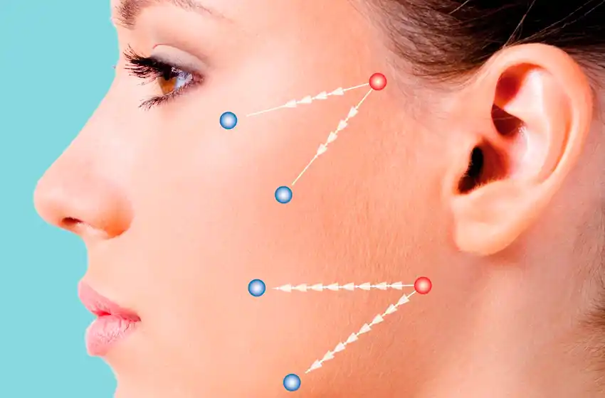 Beneficios y secretos de los hilos tensores en el rostro