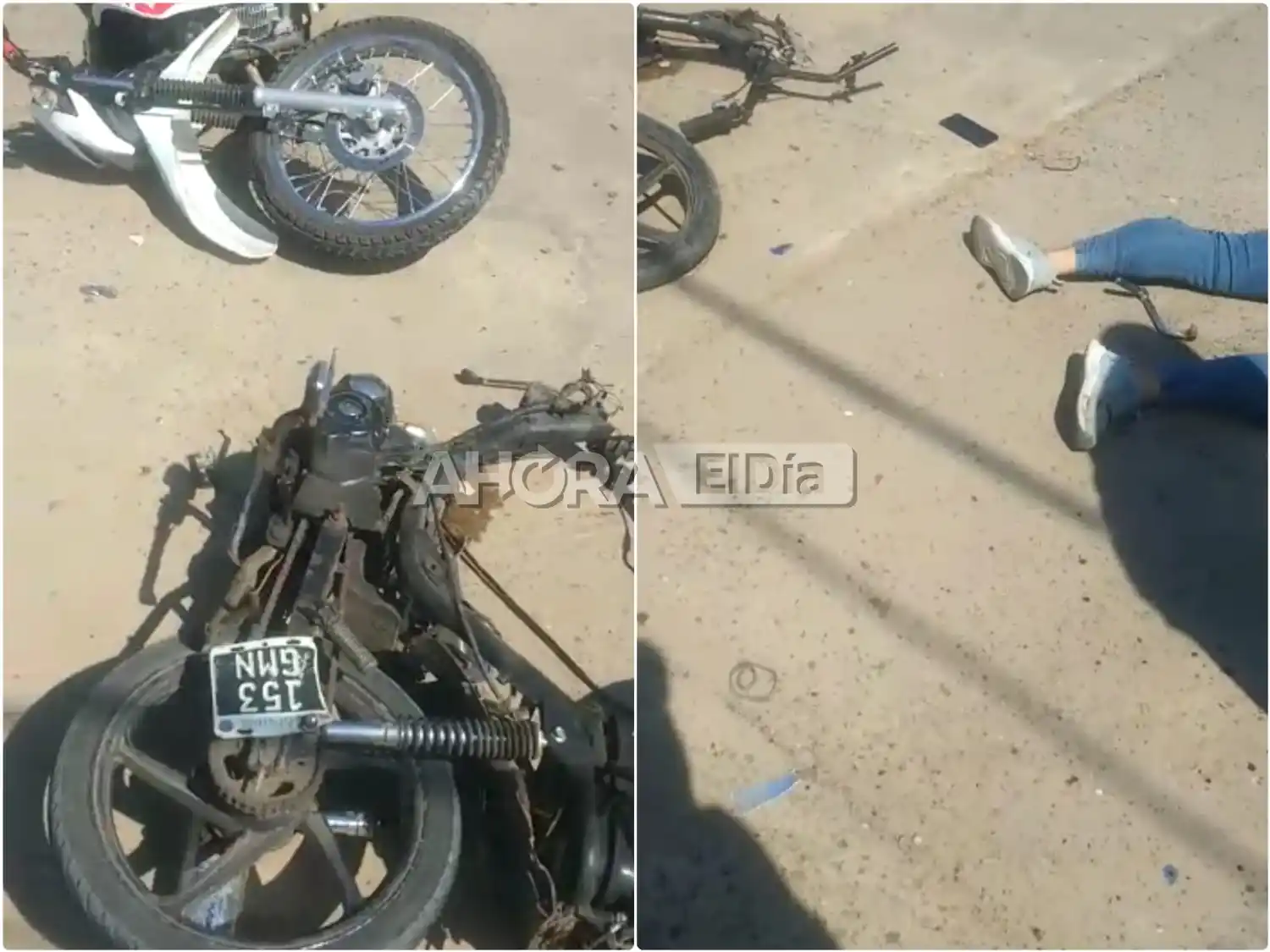 Revelaron detalles del terrible accidente que tiene al joven de 18 años peleando por su vida