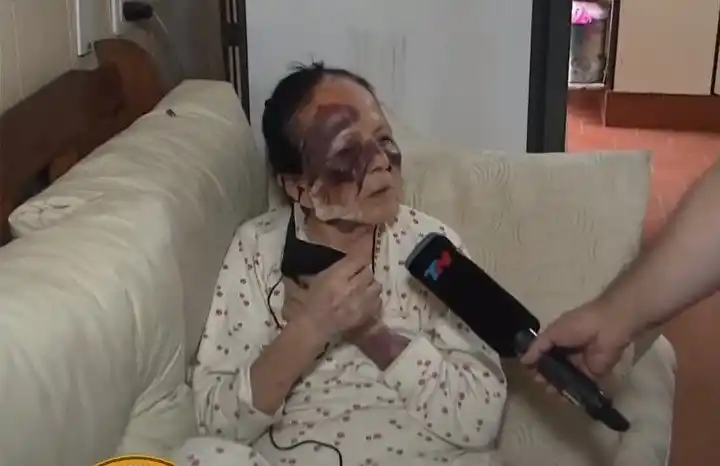 Inseguridad salvaje en San Martín: Desfiguraron a una jubilada para robarle pintura y la tarjeta SUBE