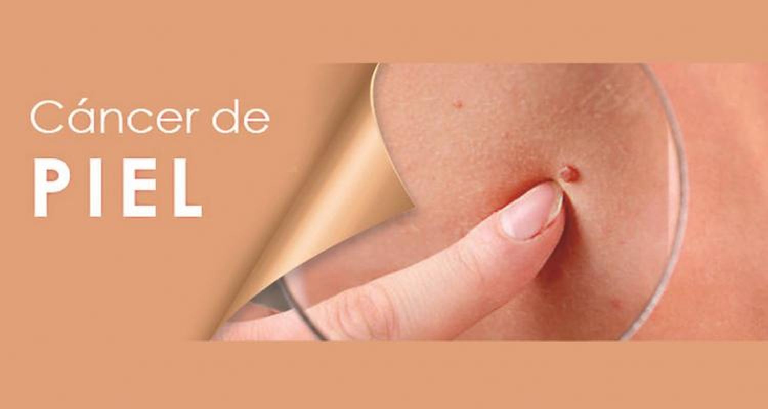 > Contra el cáncer de Piel