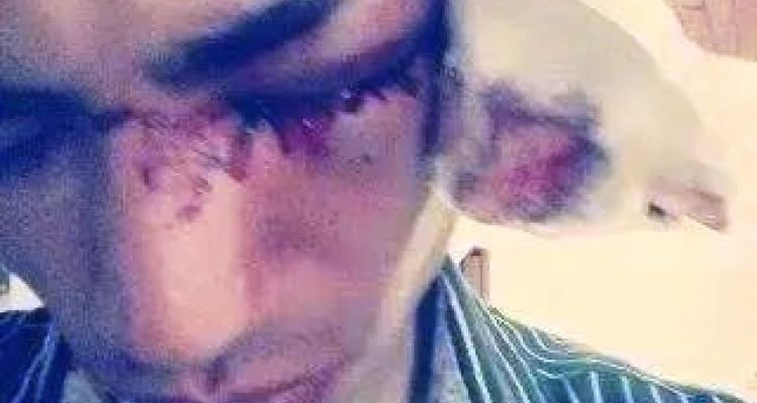 Denuncian a “patovica” por agresión y hay versiones encontradas sobre lo sucedido