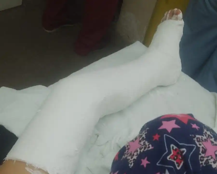 La niña jugaba en un árbol y se quebró una de sus piernas. Vive en Gobernador Castro.