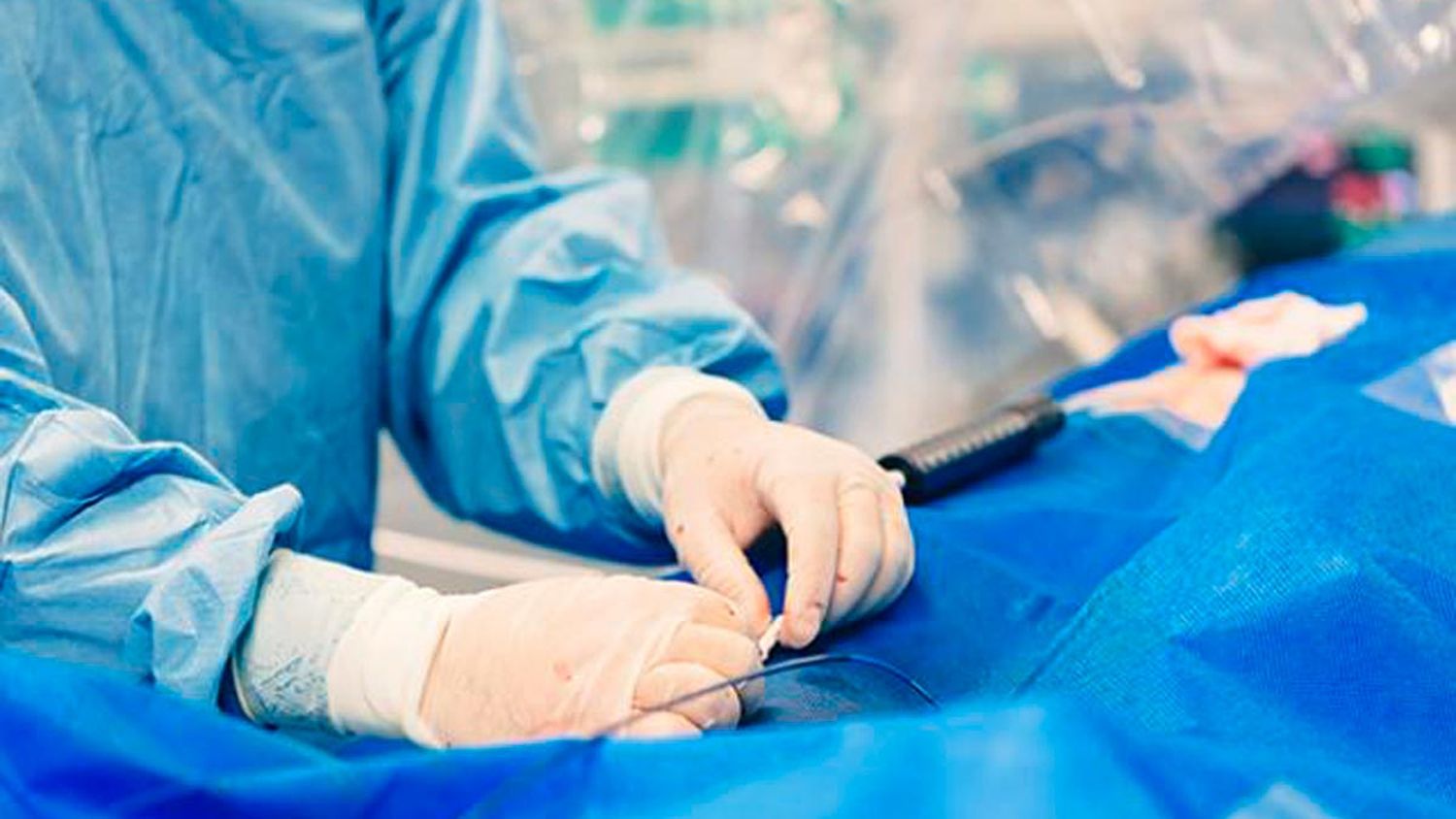 Desde el Colegio de Cardioangiólogos advirten que peligran la colocación de stents